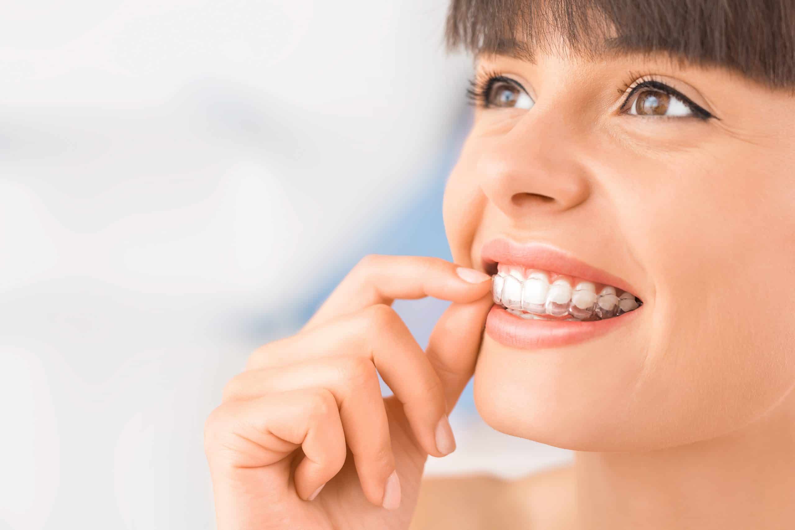 8 Facts About Invisalign Aligners - Rinaldi Dental Arts
