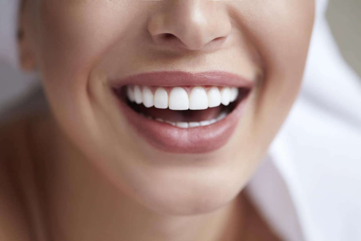 Closeup of a woman's teeth while smiling with porcelain veneers