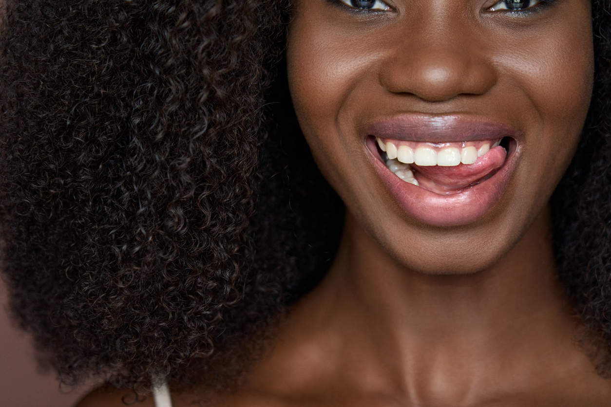 Black woman after gum whitening procedure